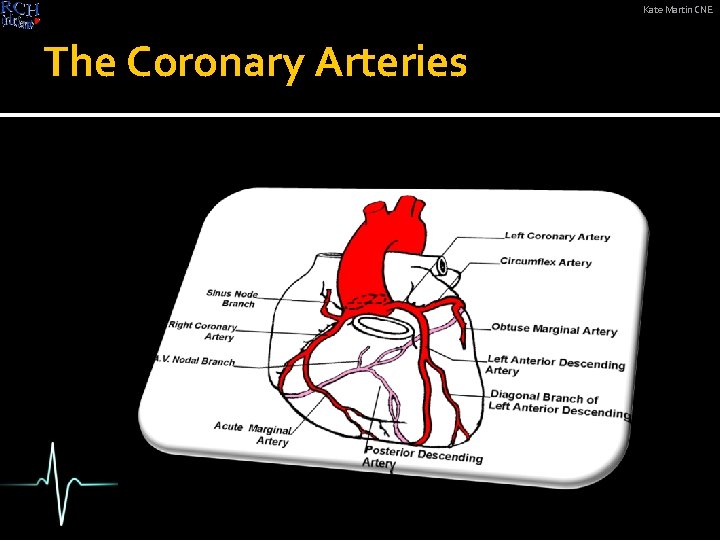 Kate Martin CNE The Coronary Arteries 
