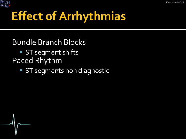 Kate Martin CNE Effect of Arrhythmias Bundle Branch Blocks ST segment shifts Paced Rhythm