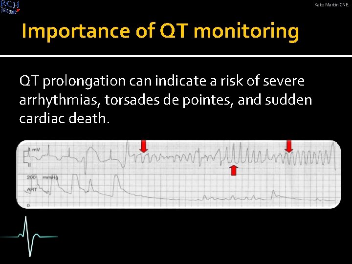 Kate Martin CNE Importance of QT monitoring QT prolongation can indicate a risk of