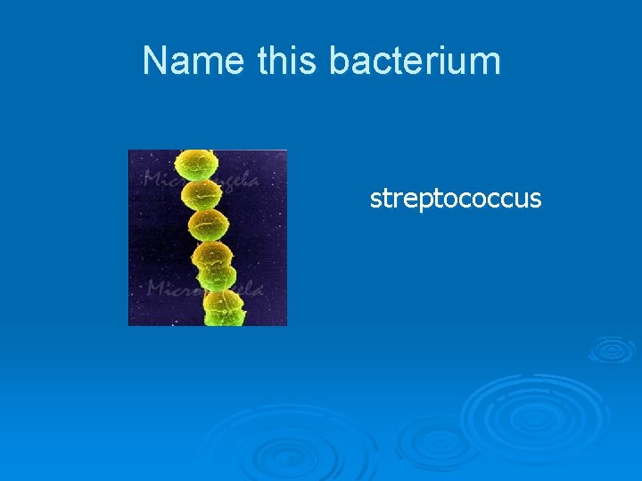Name this bacterium streptococcus 
