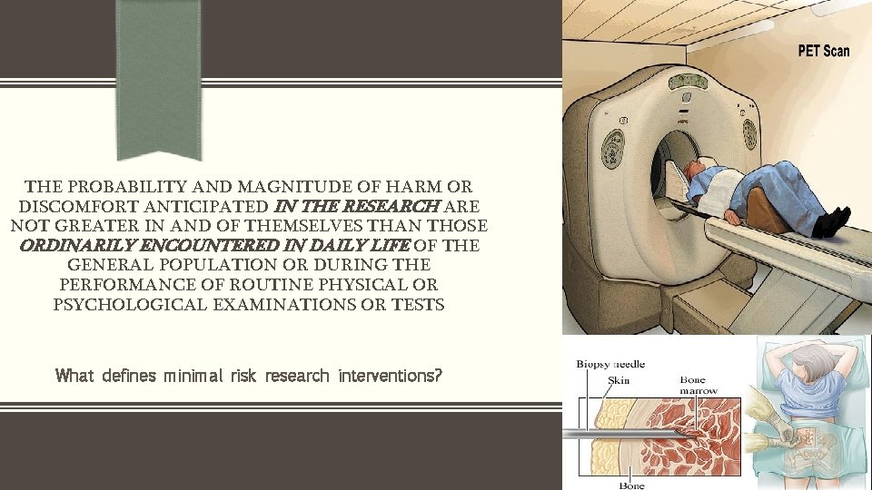 THE PROBABILITY AND MAGNITUDE OF HARM OR DISCOMFORT ANTICIPATED IN THE RESEARCH ARE NOT