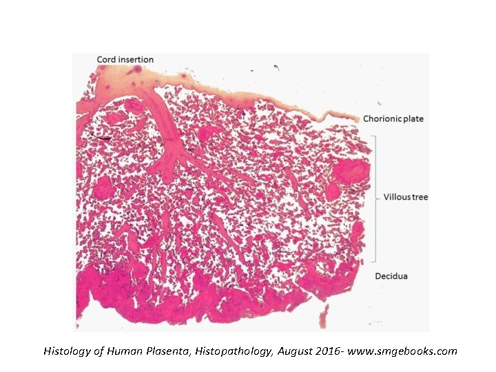 Histology of Human Plasenta, Histopathology, August 2016 - www. smgebooks. com 