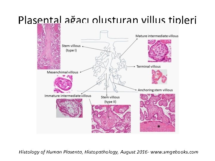 Plasental ağacı oluşturan villus tipleri Histology of Human Plasenta, Histopathology, August 2016 - www.