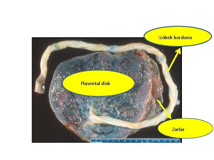 Göbek kordonu Plasental disk Zarlar 