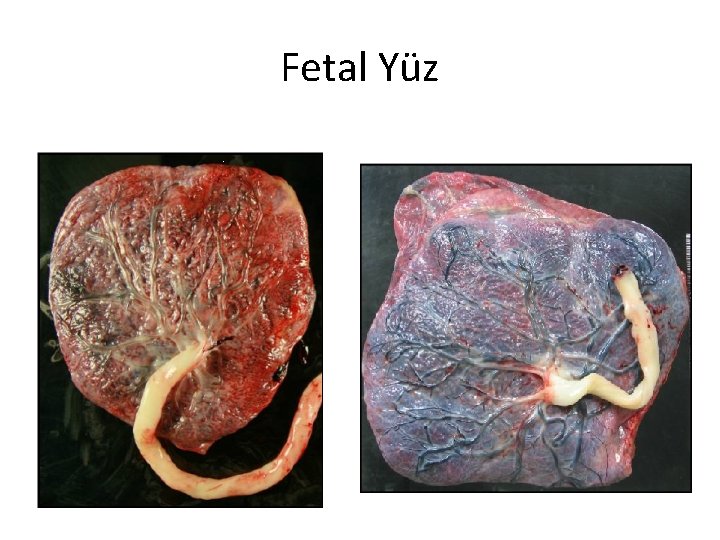 Fetal Yüz 