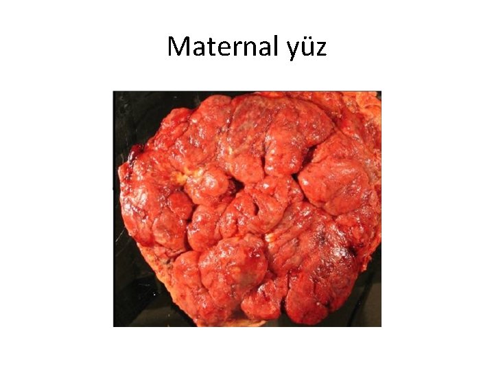 Maternal yüz 