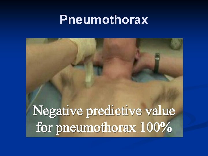 Pneumothorax Negative predictive value for pneumothorax 100% 