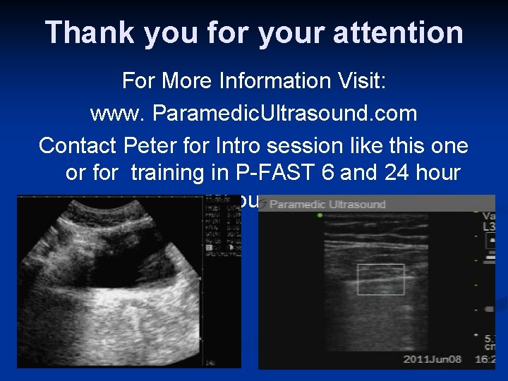 Thank you for your attention For More Information Visit: www. Paramedic. Ultrasound. com Contact