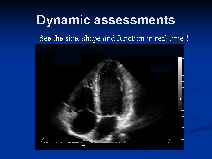 Dynamic assessments See the size, shape and function in real time ! 