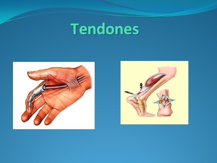 Tendones 