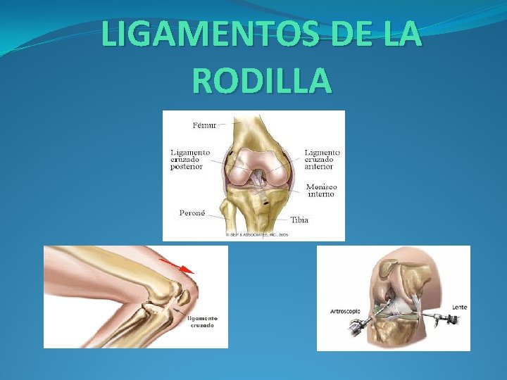 LIGAMENTOS DE LA RODILLA 