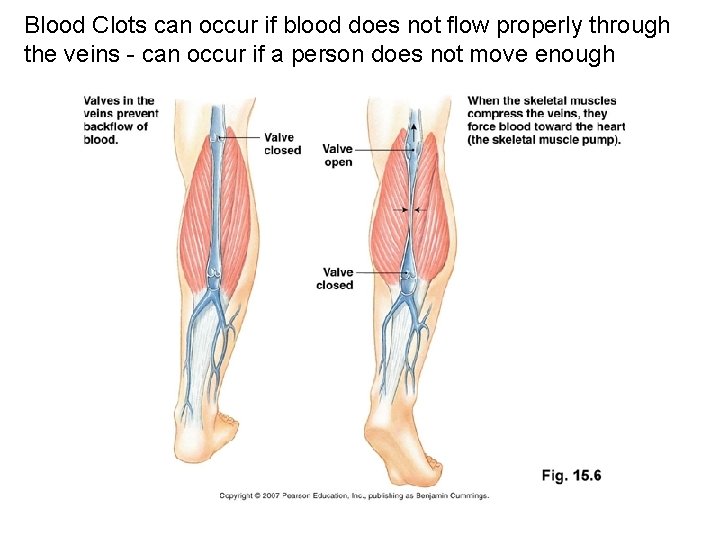 Blood Clots can occur if blood does not flow properly through the veins -