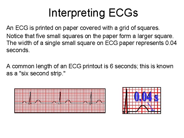 Interpreting ECGs An ECG is printed on paper covered with a grid of squares.