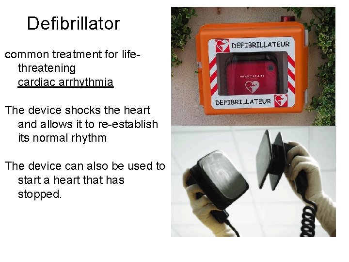 Defibrillator common treatment for lifethreatening cardiac arrhythmia The device shocks the heart and allows