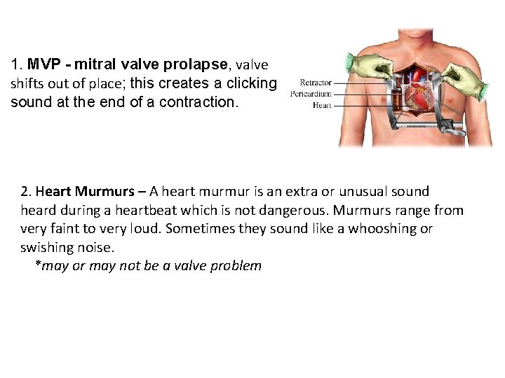 1. MVP - mitral valve prolapse, valve shifts out of place; this creates a