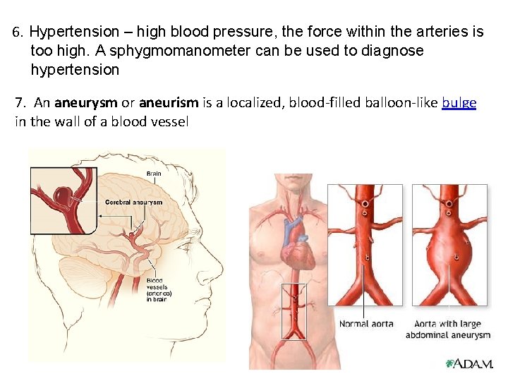 6. Hypertension – high blood pressure, the force within the arteries is too high.