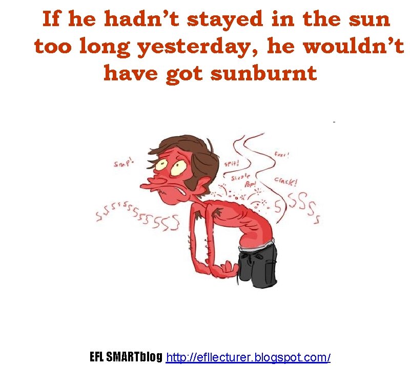 If he hadn’t stayed in the sun too long yesterday, he wouldn’t have got