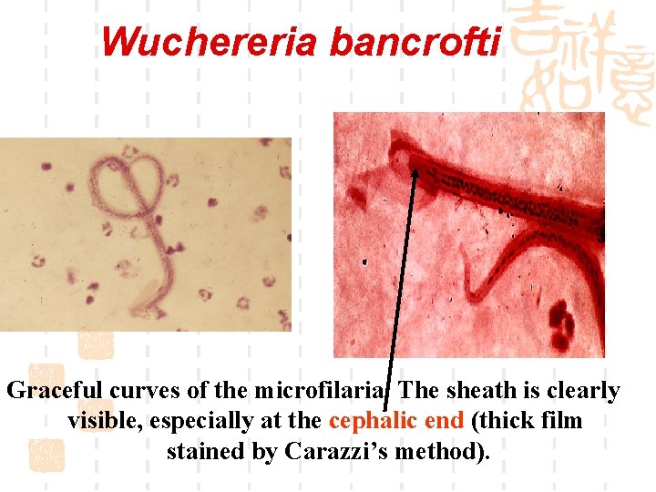 Wuchereria bancrofti Graceful curves of the microfilaria. The sheath is clearly visible, especially at