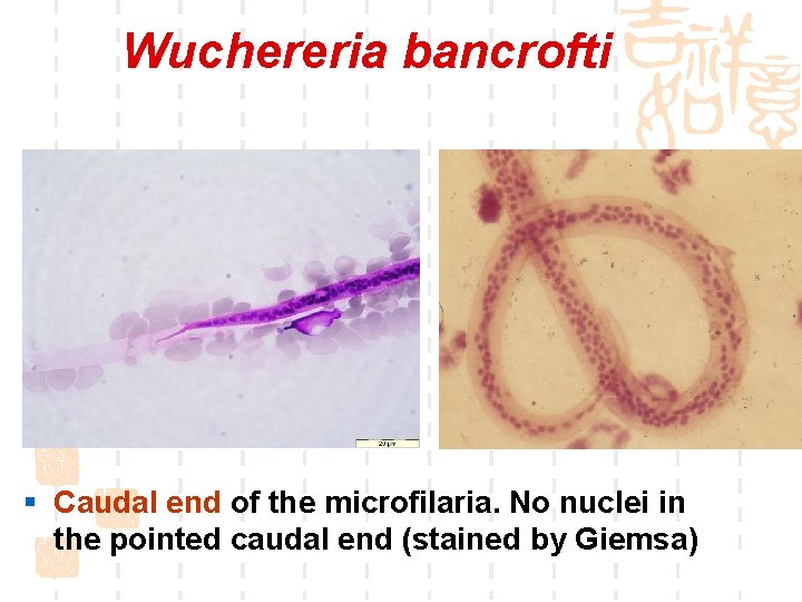Wuchereria bancrofti § Caudal end of the microfilaria. No nuclei in the pointed caudal