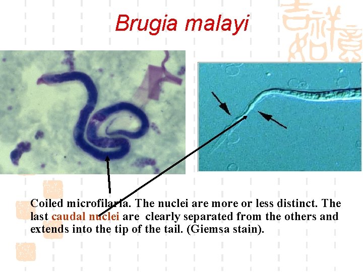 Brugia malayi Coiled microfilaria. The nuclei are more or less distinct. The last caudal