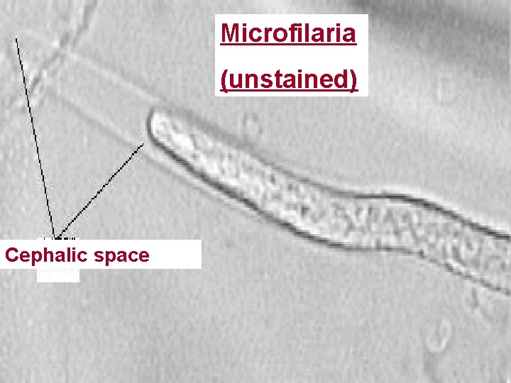 Microfilaria (unstained) Cephalic space 
