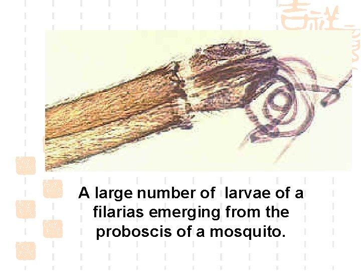 A large number of larvae of a filarias emerging from the proboscis of a
