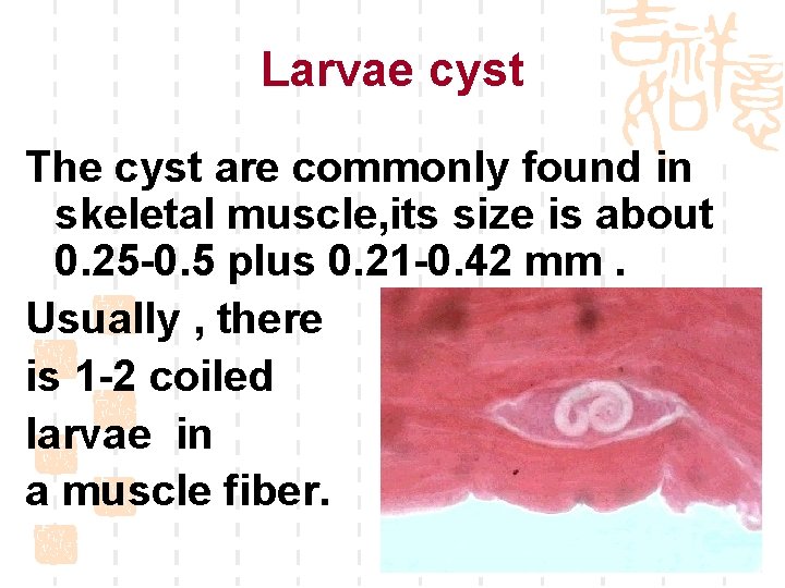 Larvae cyst The cyst are commonly found in skeletal muscle, its size is about