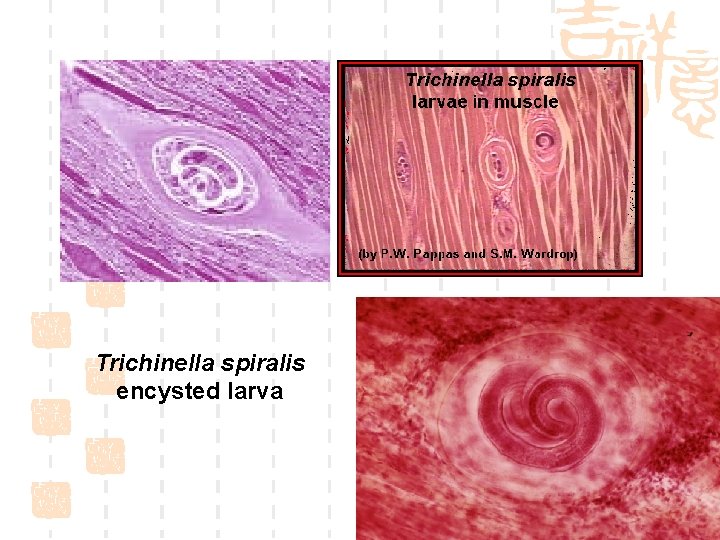 Trichinella spiralis encysted larva 