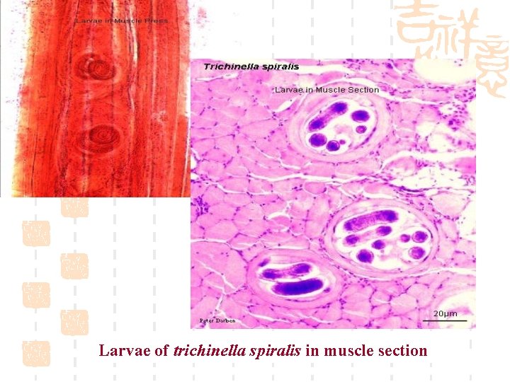 Larvae of trichinella spiralis in muscle section 