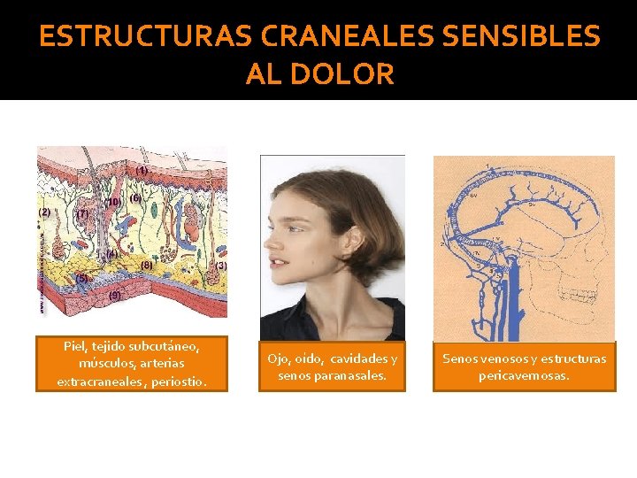 ESTRUCTURAS CRANEALES SENSIBLES AL DOLOR Piel, tejido subcutáneo, músculos, arterias extracraneales , periostio. Ojo,