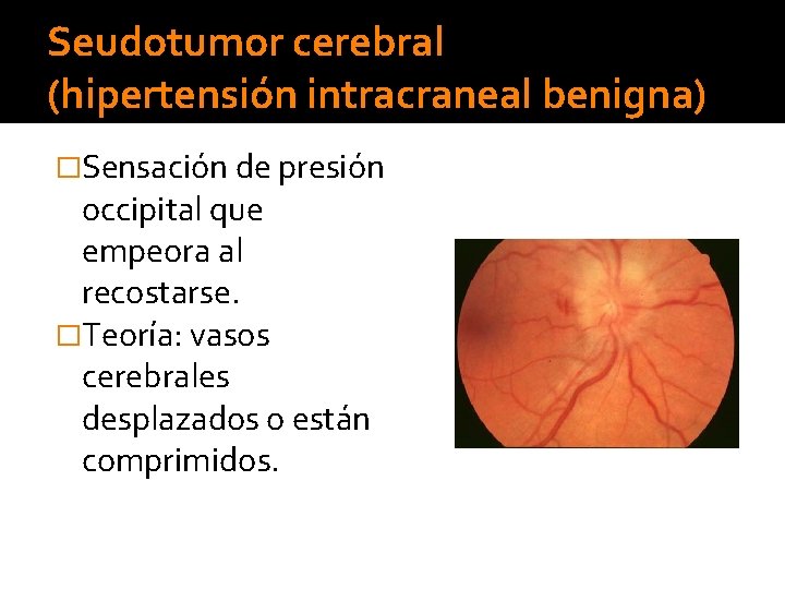 Seudotumor cerebral (hipertensión intracraneal benigna) �Sensación de presión occipital que empeora al recostarse. �Teoría: