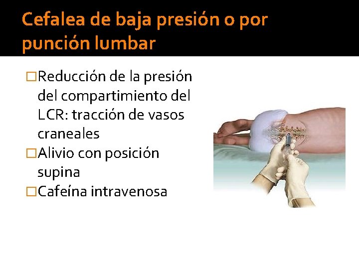 Cefalea de baja presión o por punción lumbar �Reducción de la presión del compartimiento