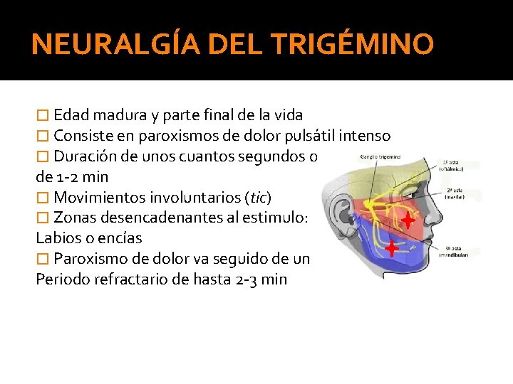 NEURALGÍA DEL TRIGÉMINO � Edad madura y parte final de la vida � Consiste