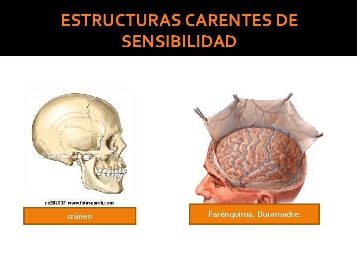 ESTRUCTURAS CARENTES DE SENSIBILIDAD cráneo Parénquima, Duramadre. 