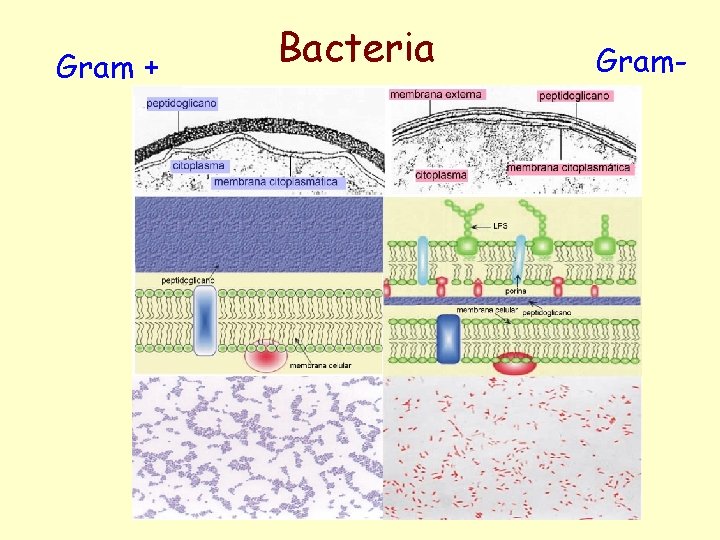 Gram + Bacteria Gram- 