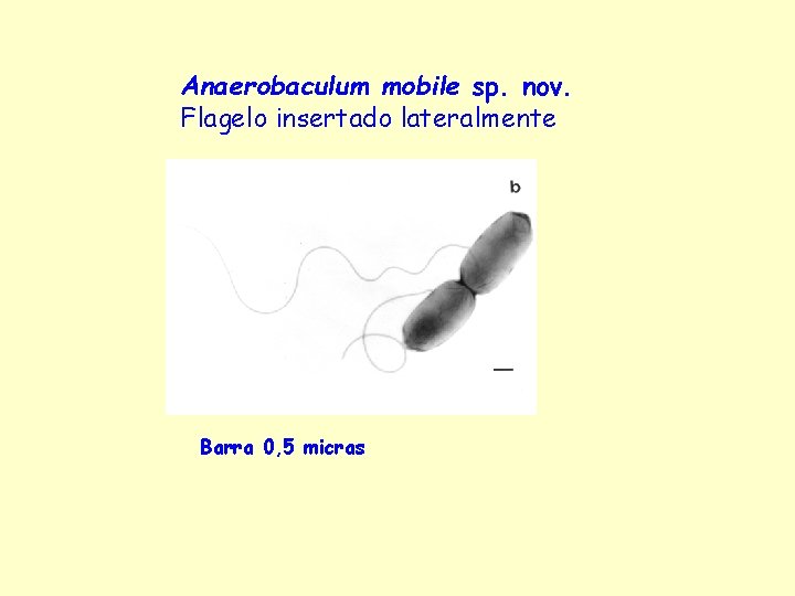 Anaerobaculum mobile sp. nov. Flagelo insertado lateralmente Barra 0, 5 micras 
