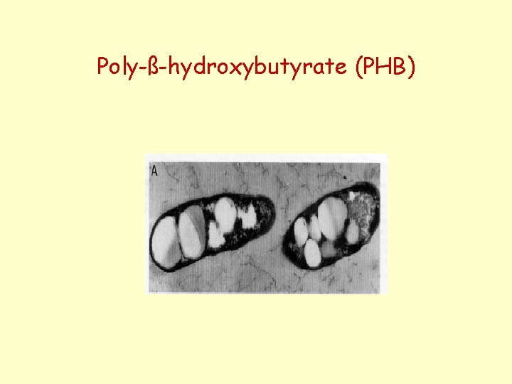 Poly-ß-hydroxybutyrate (PHB) 