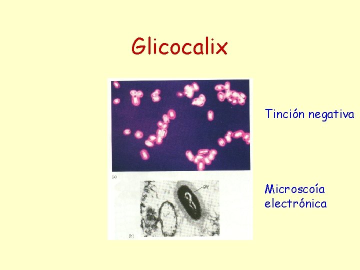 Glicocalix Tinción negativa Microscoía electrónica 