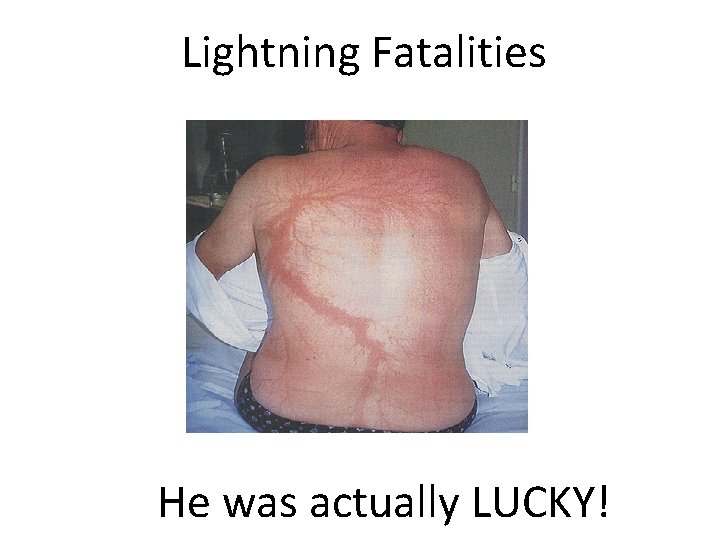 Lightning Fatalities He was actually LUCKY! 