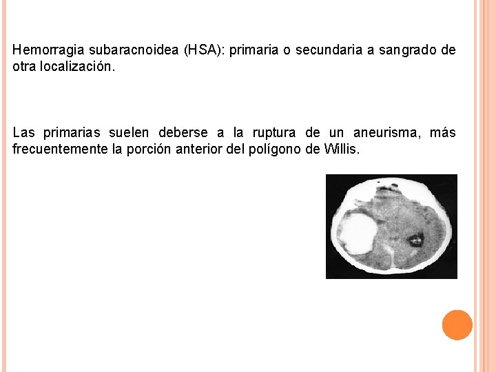 Hemorragia subaracnoidea (HSA): primaria o secundaria a sangrado de otra localización. Las primarias suelen