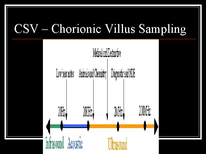 CSV – Chorionic Villus Sampling 