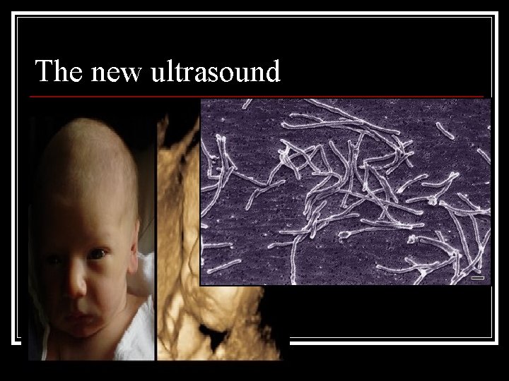 The new ultrasound 