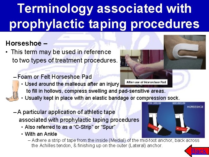 Terminology associated with prophylactic taping procedures Horseshoe – • This term may be used