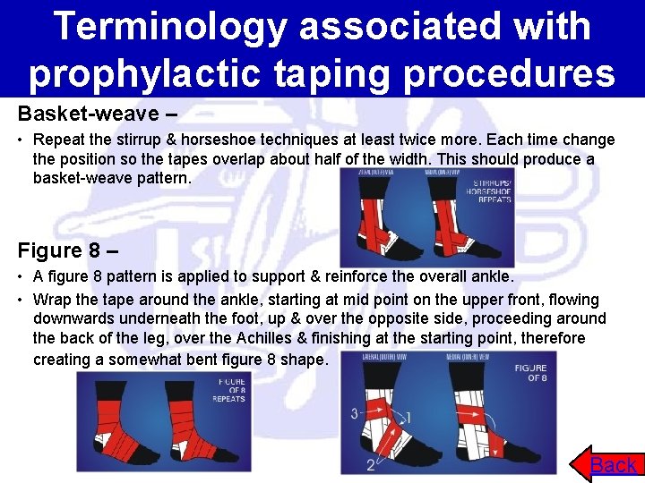 Terminology associated with prophylactic taping procedures Basket-weave – • Repeat the stirrup & horseshoe