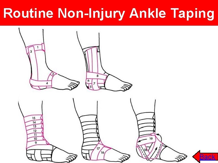 Routine Non-Injury Ankle Taping Back 
