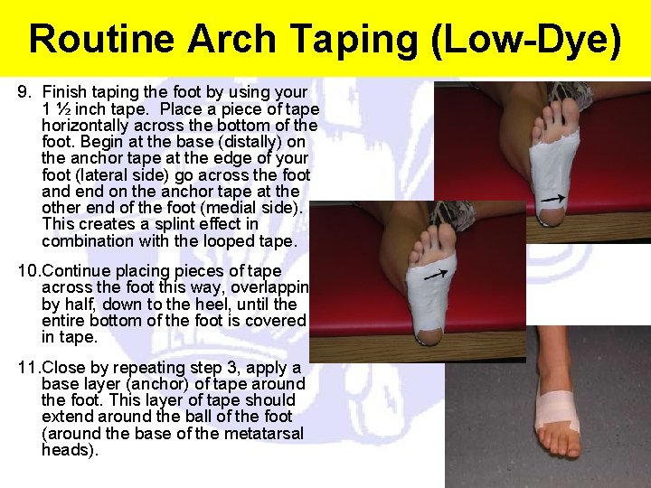Routine Arch Taping (Low-Dye) 9. Finish taping the foot by using your 1 ½ Routine Arch Taping (Low-Dye) 9. Finish taping the foot by using your 1 ½