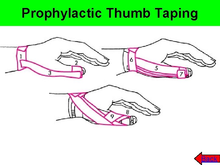 Prophylactic Thumb Taping Back 