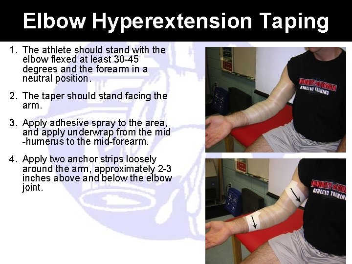 Elbow Hyperextension Taping 1. The athlete should stand with the elbow flexed at least Elbow Hyperextension Taping 1. The athlete should stand with the elbow flexed at least