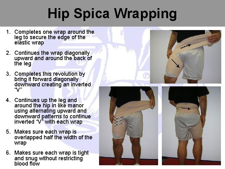 Hip Spica Wrapping 1. Completes one wrap around the leg to secure the edge