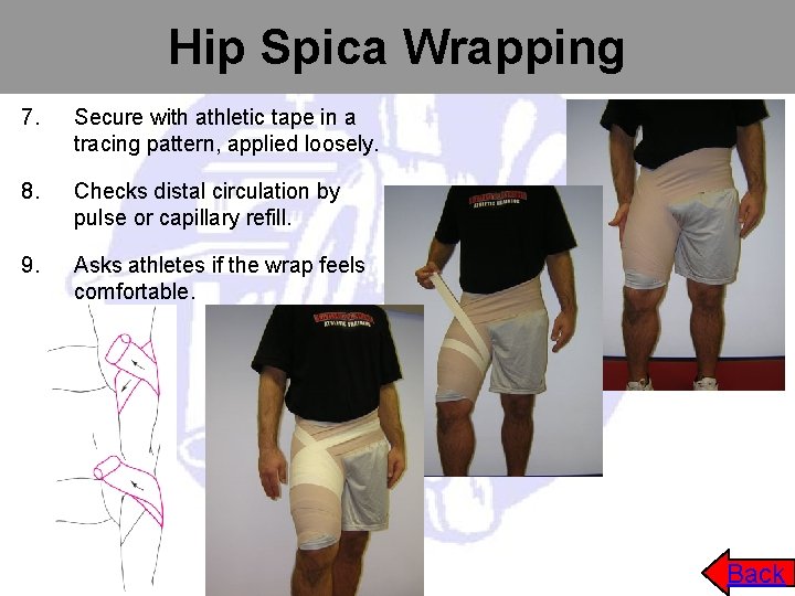 Hip Spica Wrapping 7. Secure with athletic tape in a tracing pattern, applied loosely.
